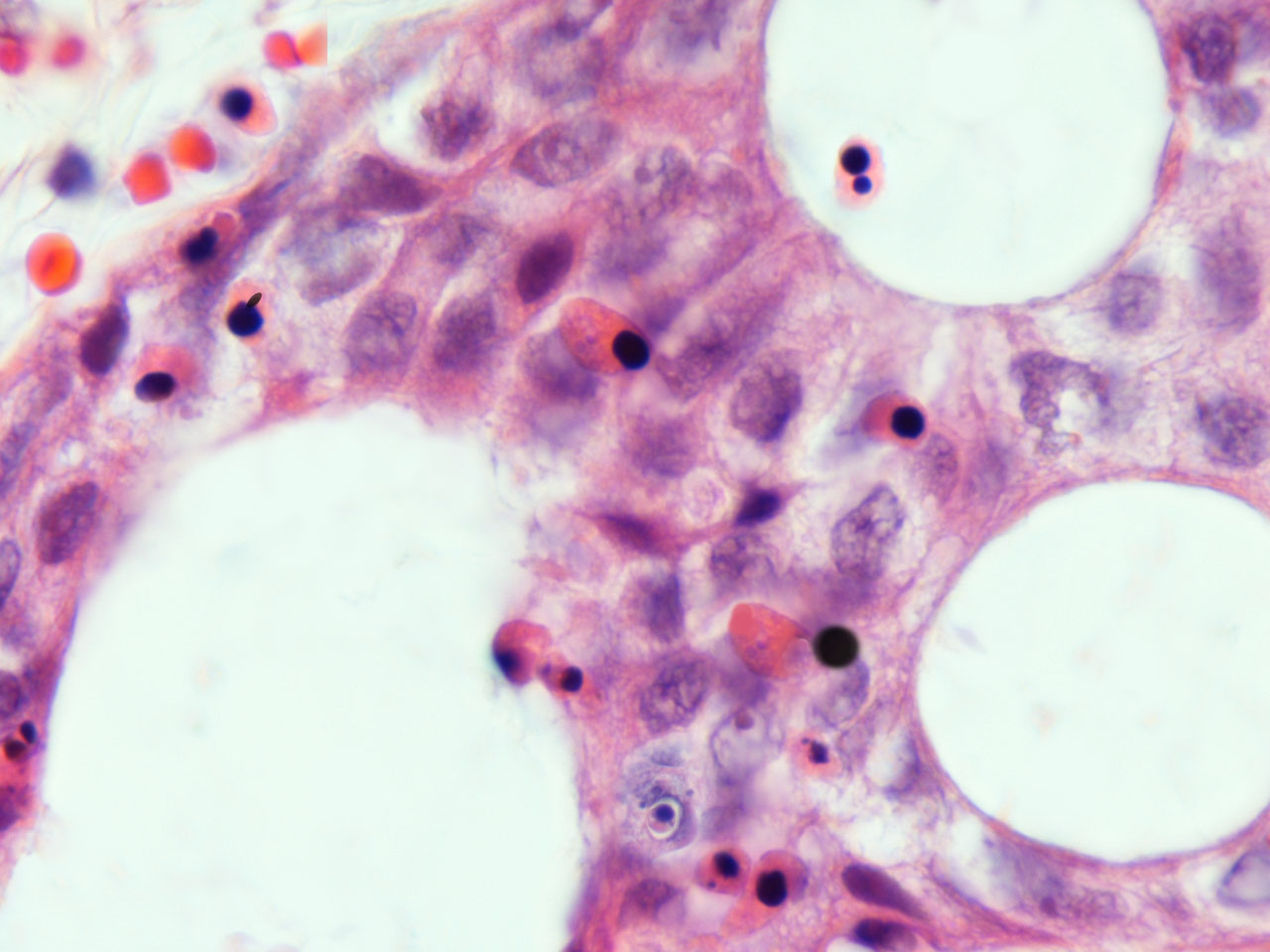 enucleating primary erythroblast